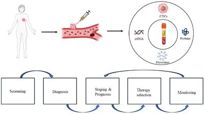 Liquid biopsy biomarkers to guide immunotherapy in breast cancer